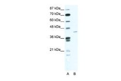 ZNF568 Rabbit anti-Human, Polyclonal, Novus Biologicals 0.1 mL | Buy Online | Novus Biologicals | Fisher Scientific